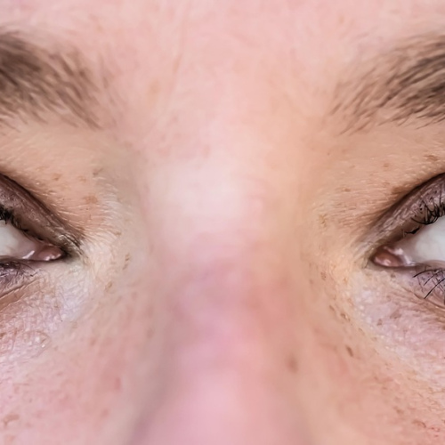 ComfortFit Toric Contact Lenses